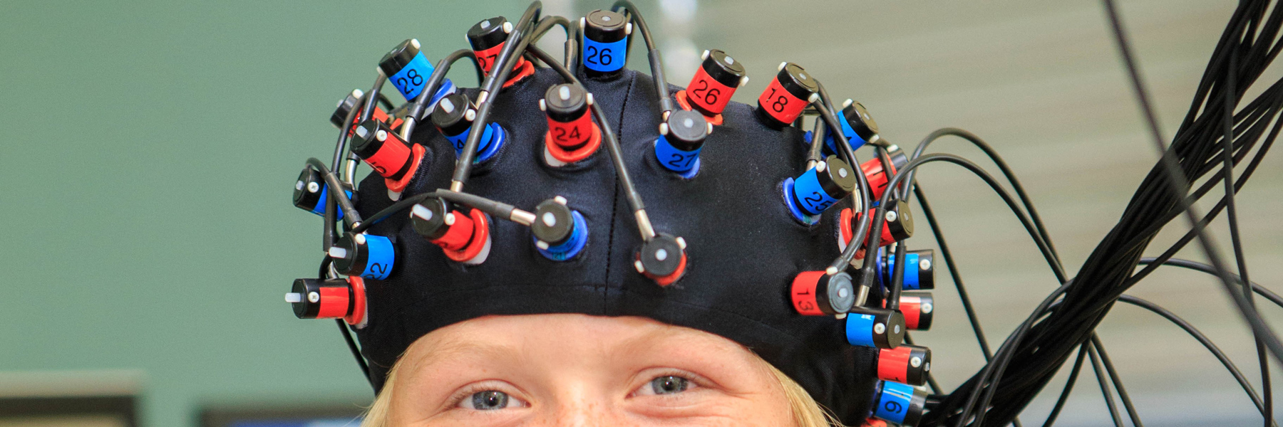 Wires on head of a girl for brain imaging.
